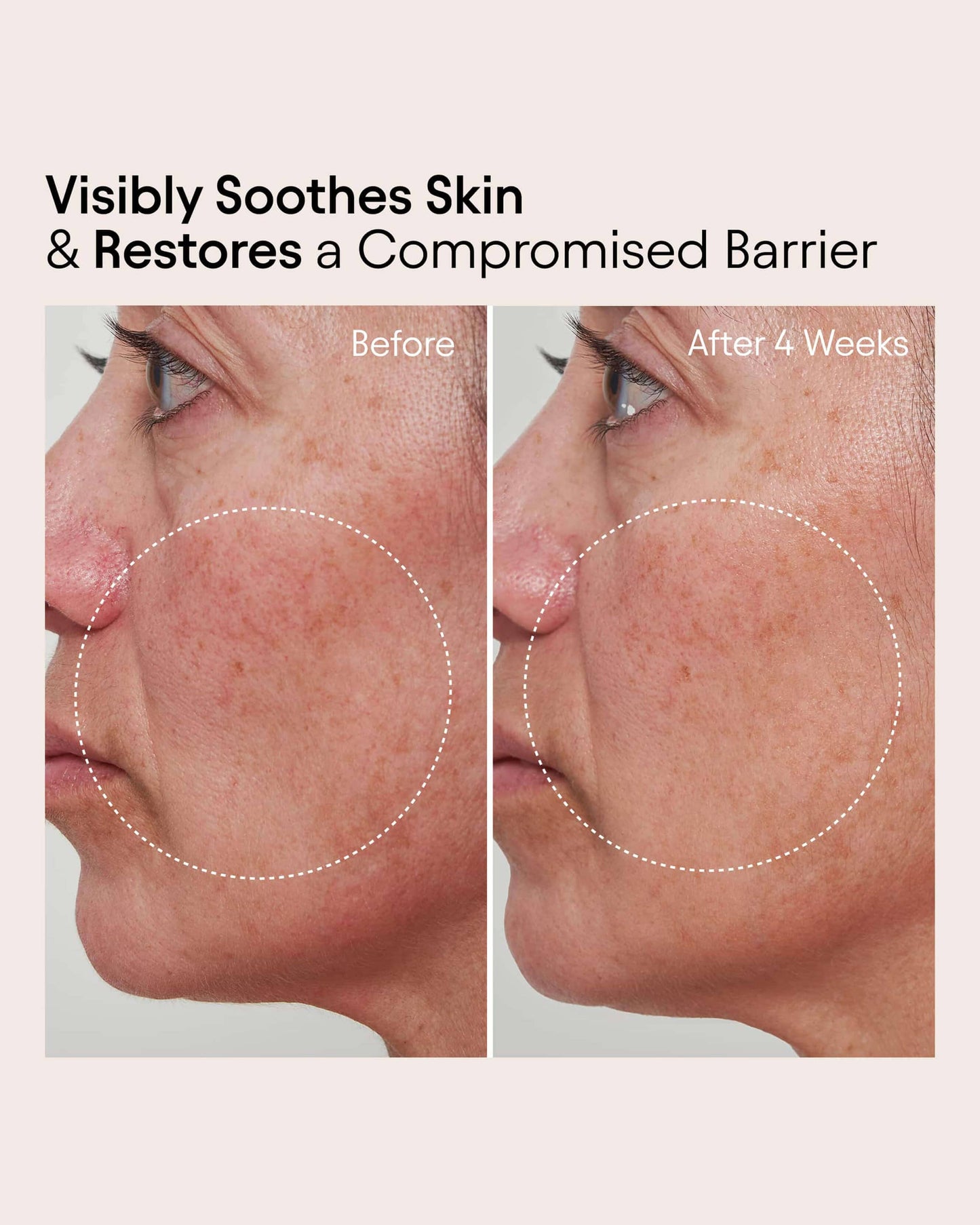 Barrier Repair Cream