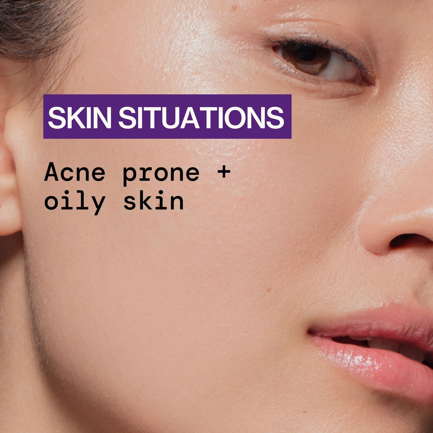 Acne Defense Face Wash