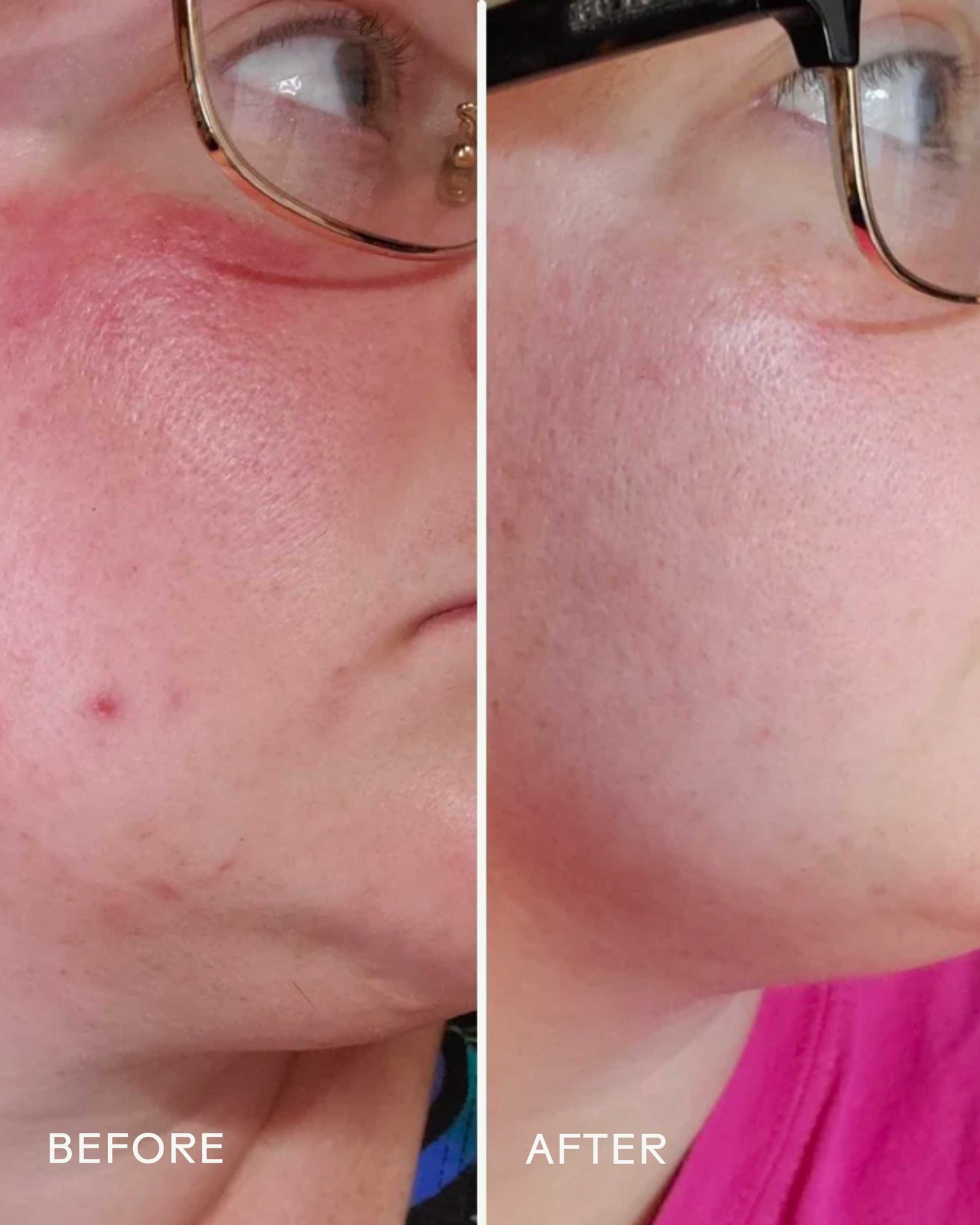 Radiance Grape Stem Cell + Squalane Day Cream