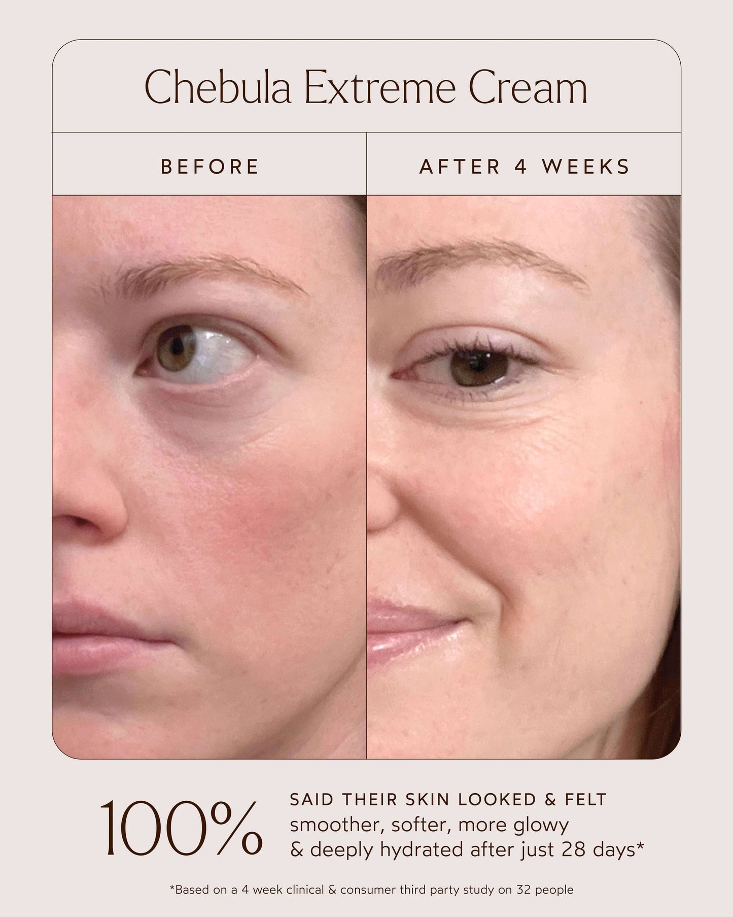 Chebula Extreme Moisture Cream