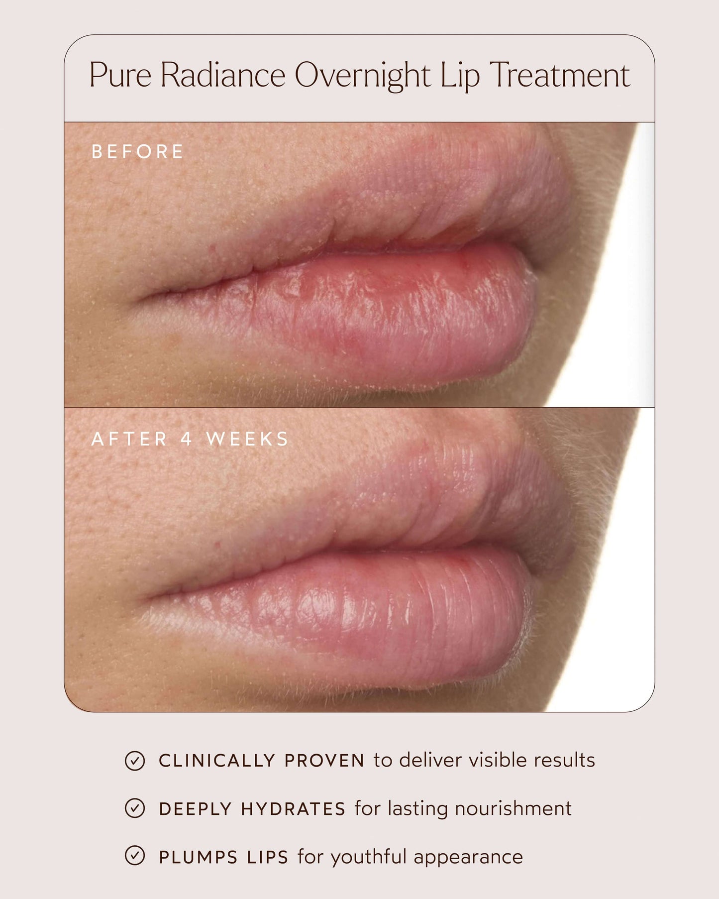 Pure Radiance Overnight Lip Treatment