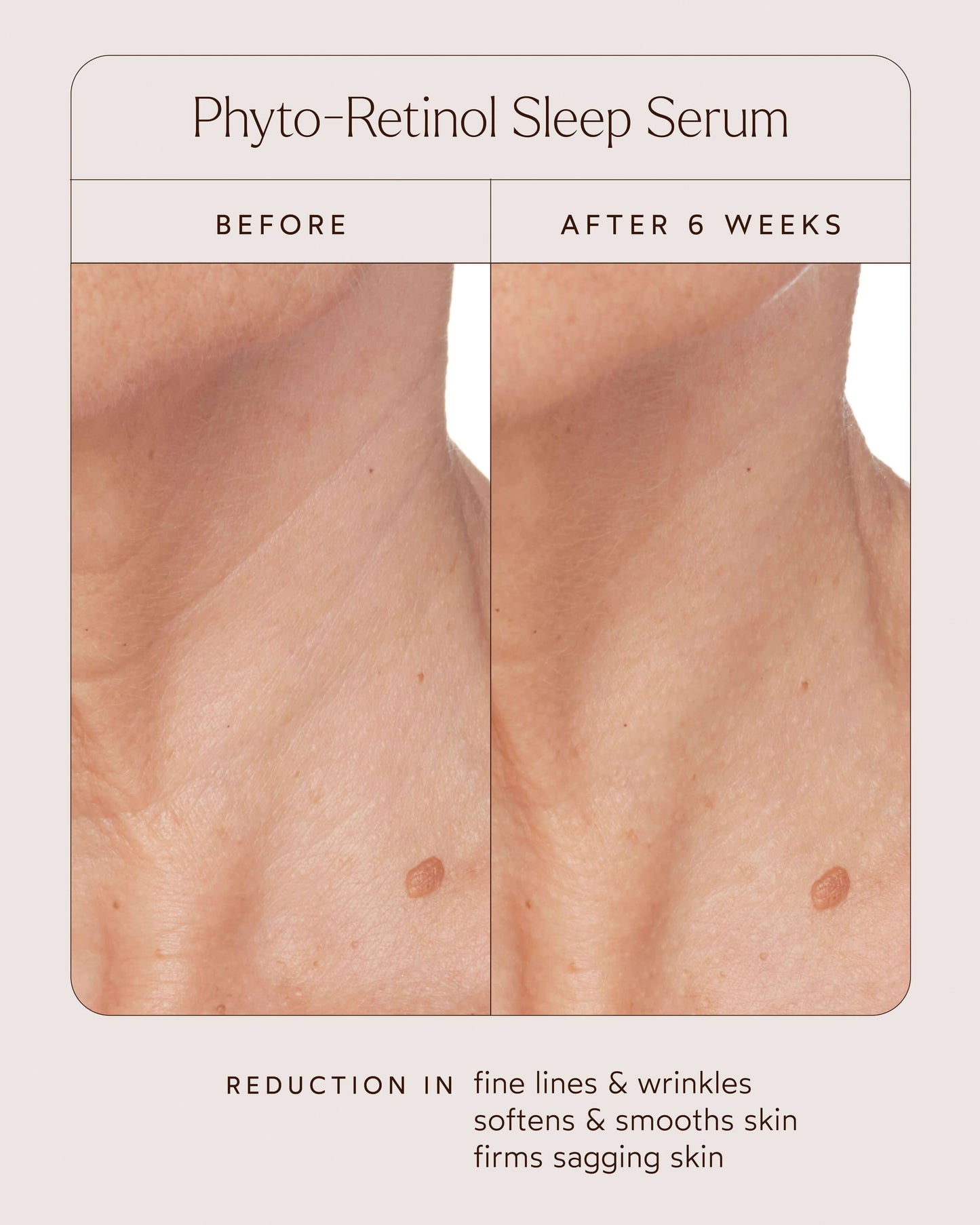 Phyto Retinol Anti-Aging Sleep Serum
