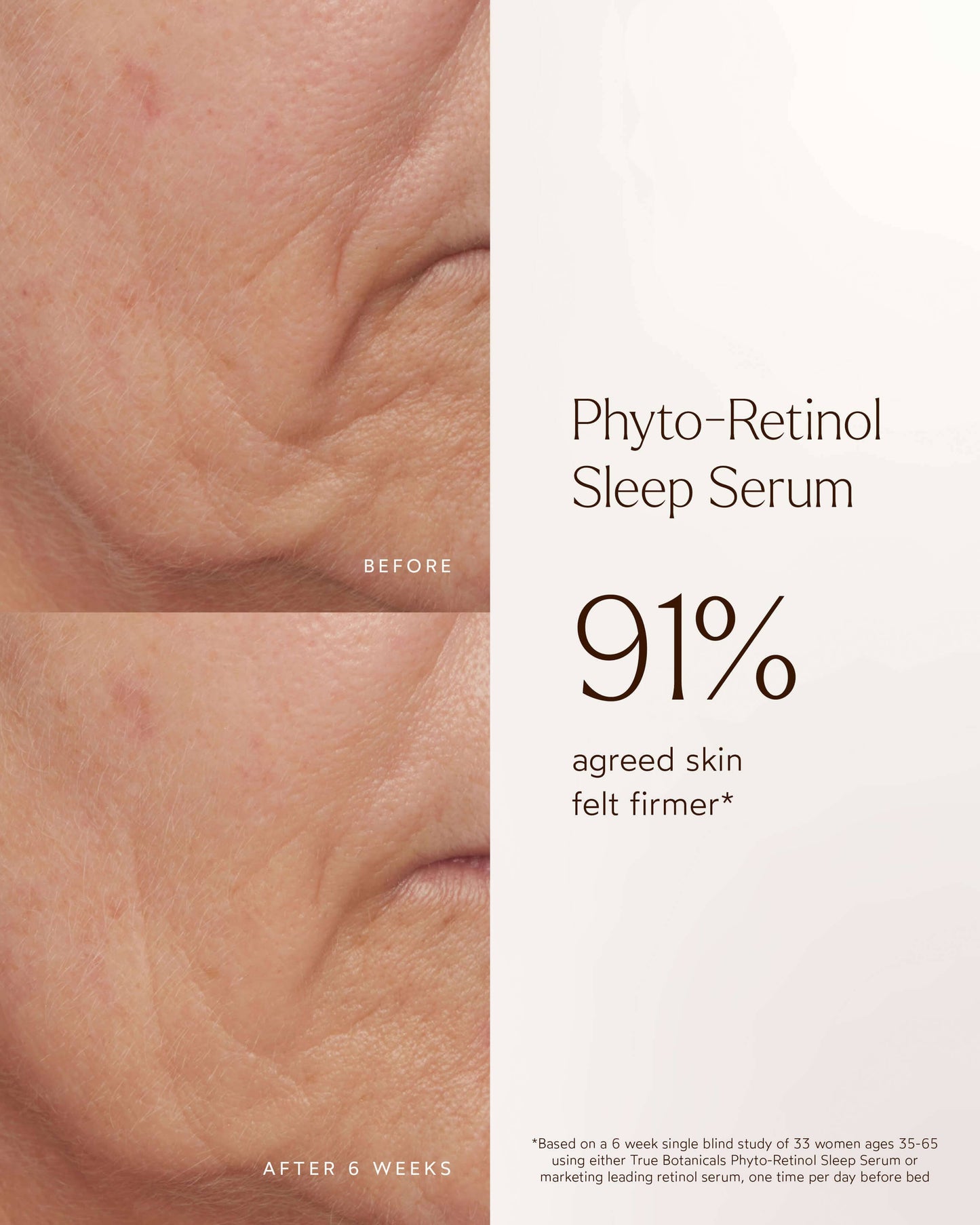 Phyto Retinol Anti-Aging Sleep Serum