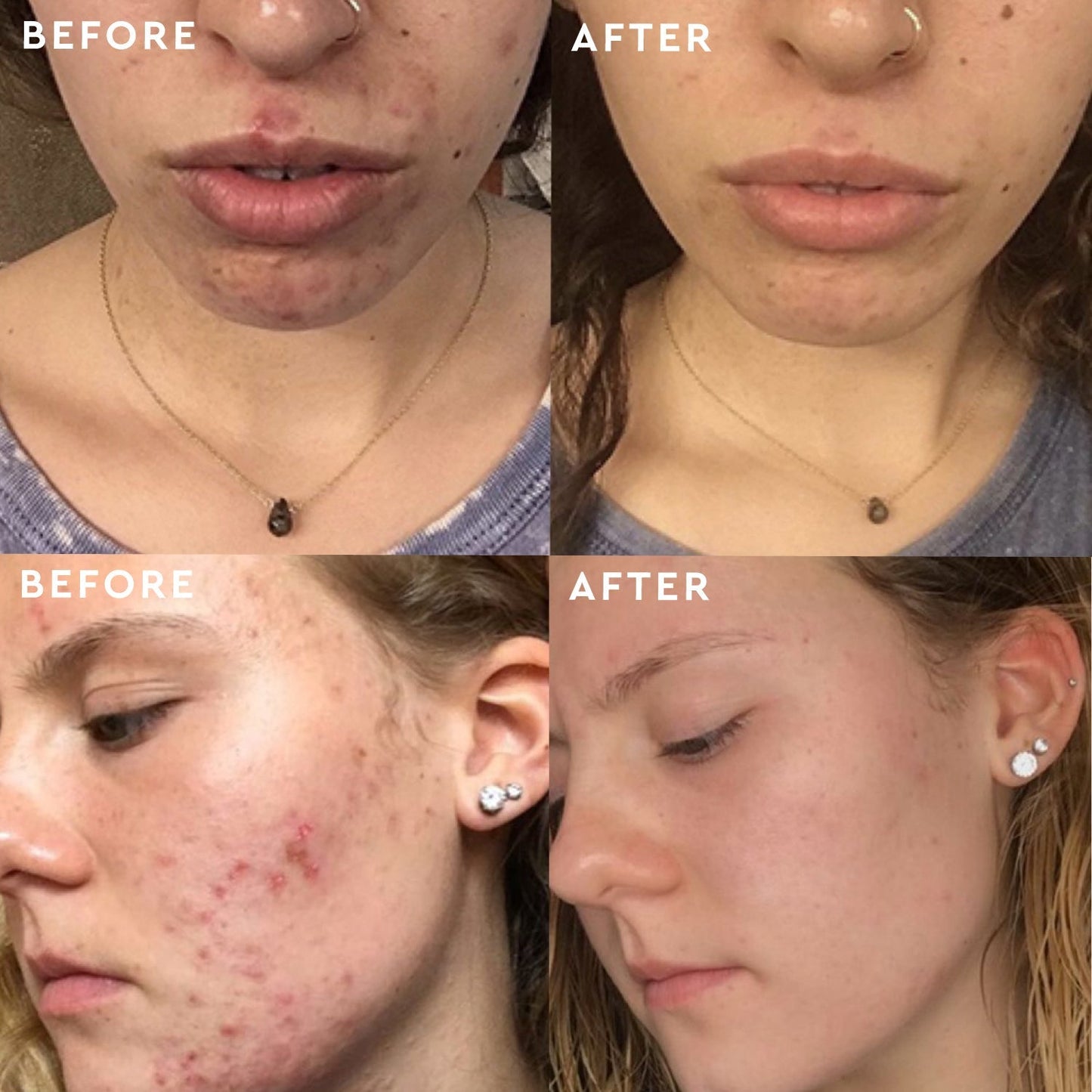 Clear Skin Routine + Body Wash