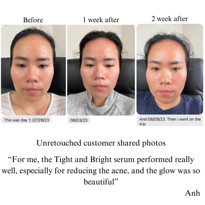 Hyperpigmentation TRIO, Brightening and Collagen Boosting Age-Defying Bundle 20% off