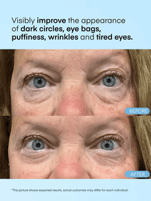 Caffeine & Hyaluronic Acid Eye Gel Patch