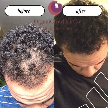 Grow Gold Bundle (Low Porosity)