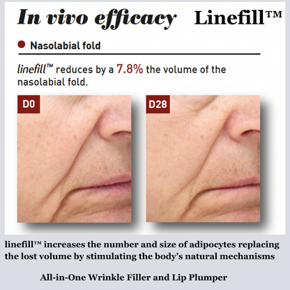 Hyperpigmentation TRIO, Brightening and Collagen Boosting Age-Defying Bundle 20% off