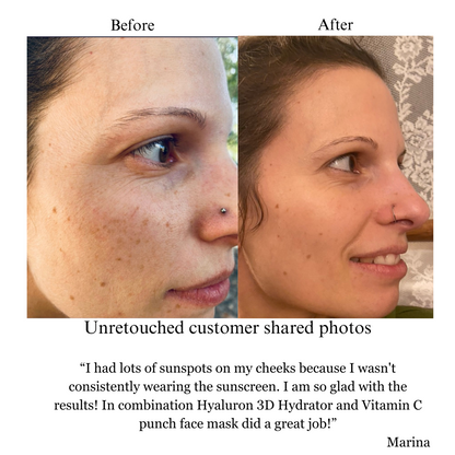 Hyperpigmentation TRIO, Brightening and Collagen Boosting Age-Defying Bundle 20% off