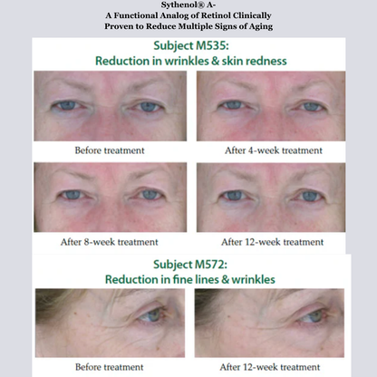 Hyperpigmentation TRIO, Brightening and Collagen Boosting Age-Defying Bundle 20% off