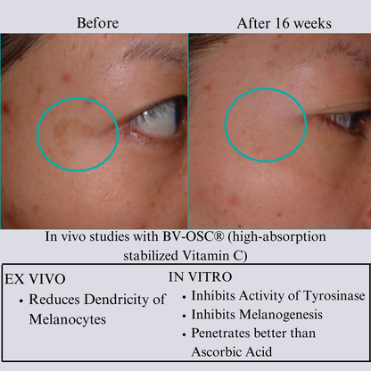 Hyperpigmentation TRIO, Brightening and Collagen Boosting Age-Defying Bundle 20% off