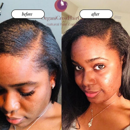 Stimulating Scalp Beverage – High with Black Seed Oil - Hair Growth Oil - Vegan America
