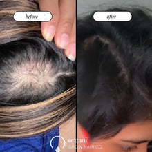 Stimulating Scalp Beverage - Medium Porosity with Black Seed Oil - Hair Growth Oil