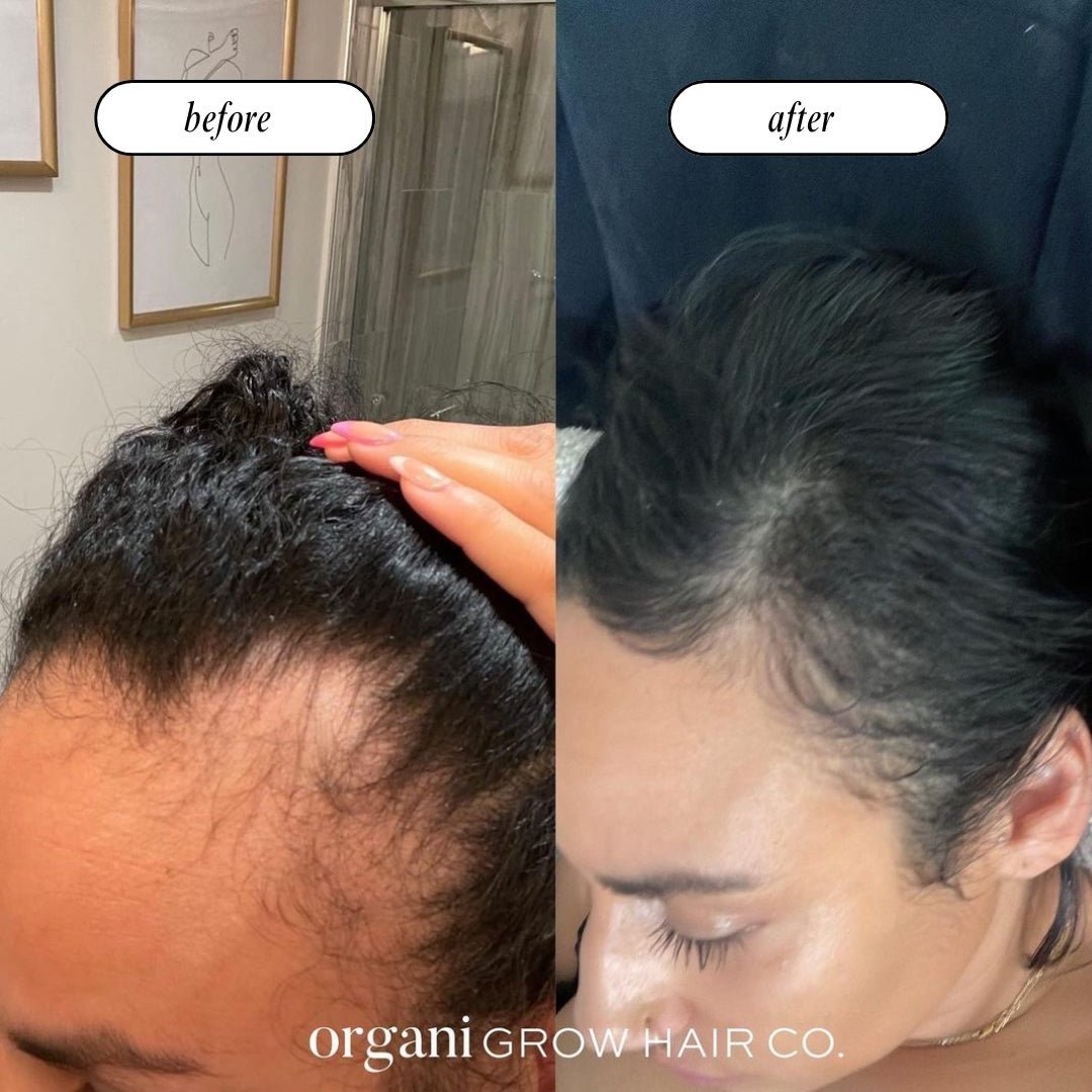 Stimulating Scalp Beverage – High with Black Seed Oil - Hair Growth Oil - Vegan America