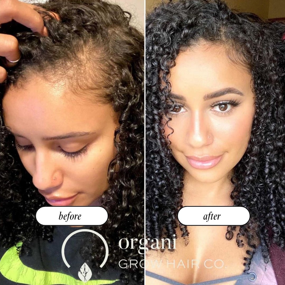 Stimulating Scalp Beverage – High with Black Seed Oil - Hair Growth Oil - Vegan America