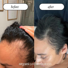 Grow N Glow Hair Skin Nails Anti Aging Multivitamins - Vegan America