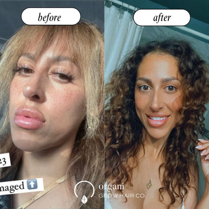 The Condish (Protein)