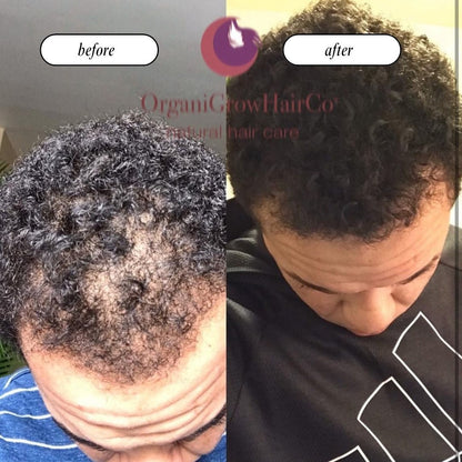Stimulating Scalp Beverage – High with Black Seed Oil - Hair Growth Oil - Vegan America