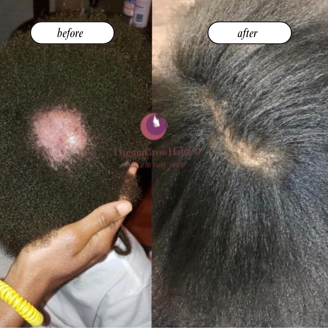 Stimulating Scalp Beverage – High with Black Seed Oil - Hair Growth Oil - Vegan America