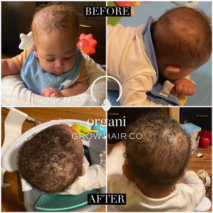 Stimulating Scalp Beverage - Medium Porosity with Black Seed Oil - Hair Growth Oil